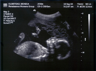 Baby Mojo